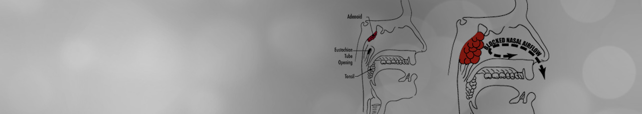 Pediatric ENT / Children